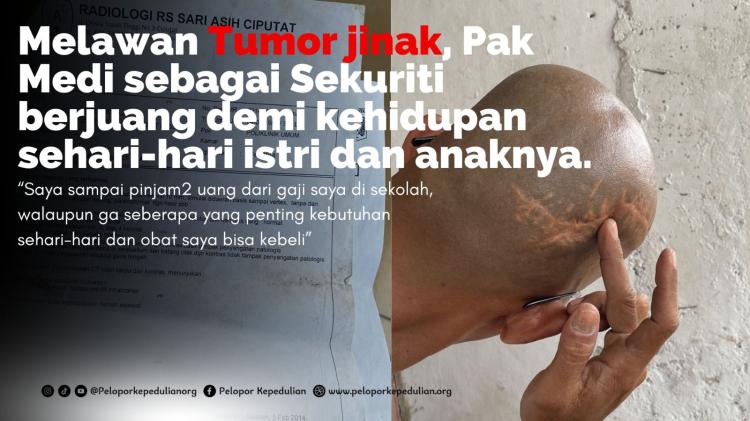 Banner program Pak Meidi, Satpam Sekolah yang Berjuang Melawan Tumor Jinak di Kepalanya
