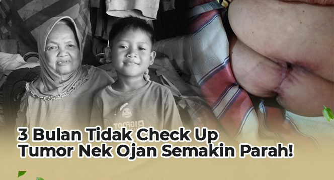 Banner program Tumbuh Daging di Perut, Nenek Ojan Alami Tumor Perut