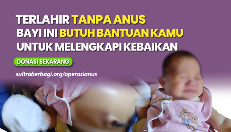 Gambar banner Lahir tanpa lubang anus, Bayi mungil ini butuh kamu untuk melengkapi kebaikan Gambar banner Lahir tanpa lubang anus, Bayi mungil ini butuh kamu untuk melengkapi kebaikan