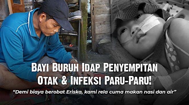 Gambar banner Dik Eriska Idap Penyakit Komplikasi, Harus Buru-Buru Berobat