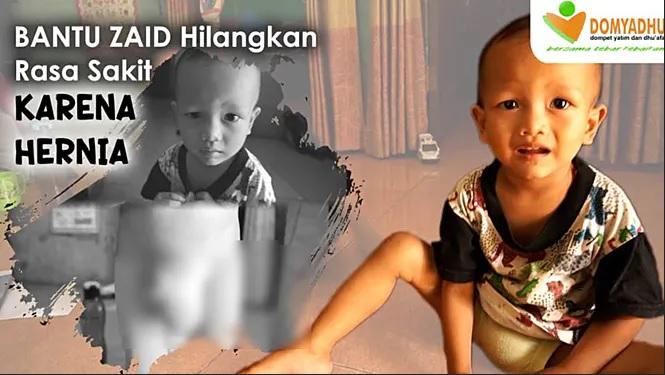 Gambar banner Bantu Zaid hilangkan rasa sakit karena hernia Gambar banner Bantu Zaid hilangkan rasa sakit karena hernia