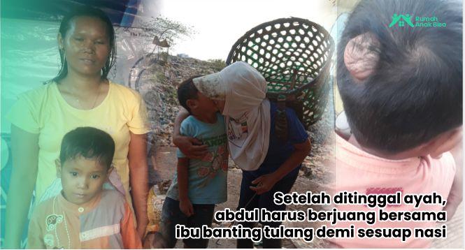 Gambar banner Benjolan Di Belakang Kepala Membuat Adik Abdul Kasakitan