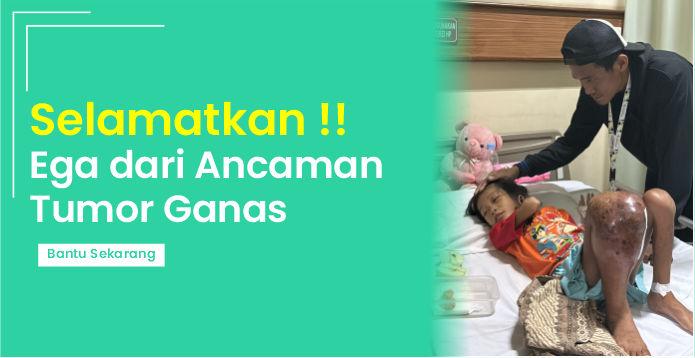 Gambar banner Urgent, Bantu Ega Dari Tumor Ganas Gambar banner Urgent, Bantu Ega Dari Tumor Ganas