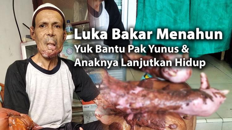 Gambar banner Menahan Sakit, Pak Yunus Berjuang Hidupi Anaknya Gambar banner Menahan Sakit, Pak Yunus Berjuang Hidupi Anaknya