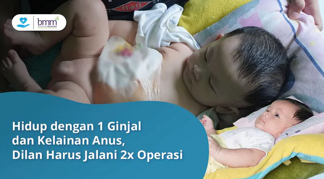 Banner program PATUNGAN OPERASI ANUS DEDEK DILAN