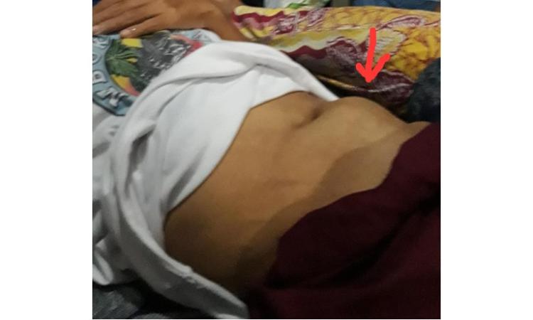 Banner program BANTU PAK HARDI SEMANGAT SEMBUH DARI PENYAKIT KOMPILASI AKUT 