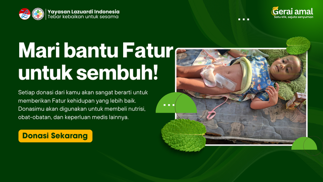 Banner program Mari bantu Fatur untuk sembuh